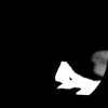 SPORK, NICO - 22.03.1976 - 02.08.2022 - CT obere Extremität - 17:51:17